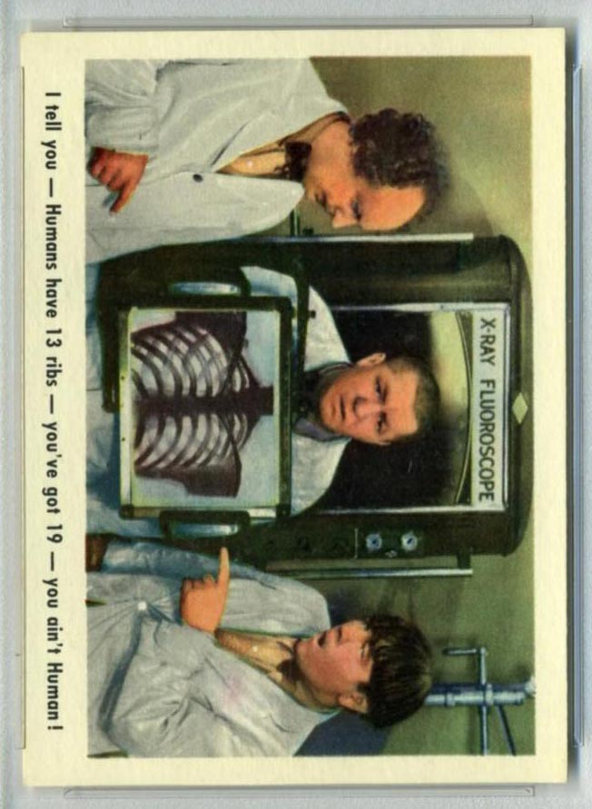 1959 Fleer Three Stooges #14 X-Ray - Front